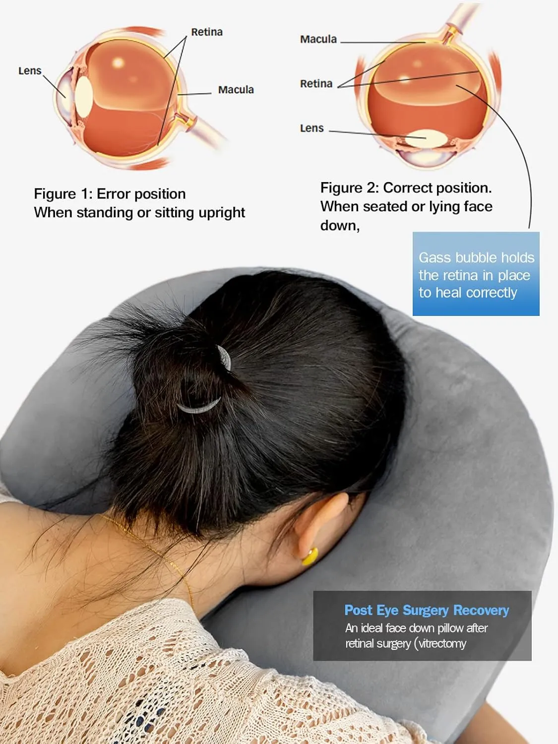Face Down Pillow After Eye Surgery, Adjustable Height Prone Prone Face Down Sleeping, Retina Lying Pillow, Vitrectomy Macular Hole Retinal Detachment Recovery Equipment Eye Surgery Support
